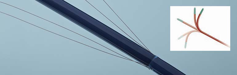 Steerable Catheter